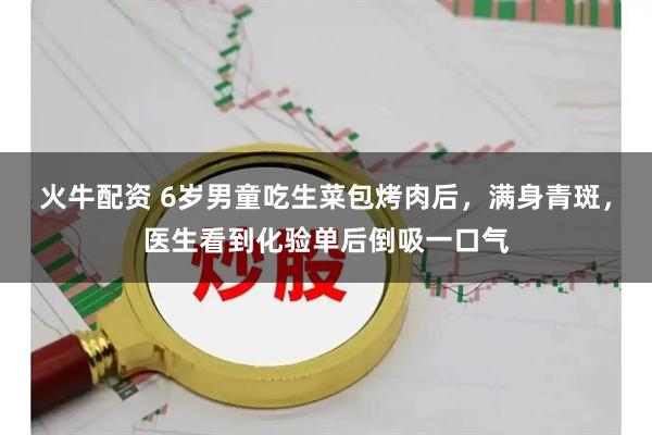 火牛配资 6岁男童吃生菜包烤肉后，满身青斑，医生看到化验单后倒吸一口气